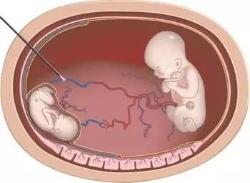 名侦探柯南计时引爆摩天楼(普通话版)
